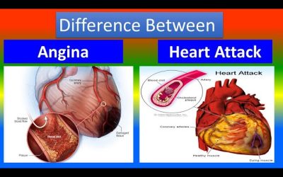 What is the Difference Between Heart Attack and Angina