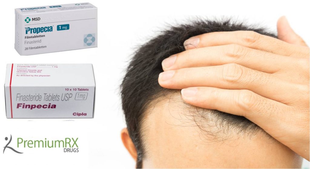 Finasteride 1mg for Hair Loss,- Propecia and Finpecia