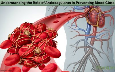 Understanding the Role of Anticoagulants in Preventing Blood Clots